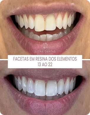 imagem 28