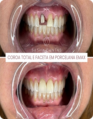 imagem 29