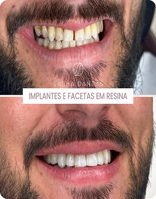 imagem 31