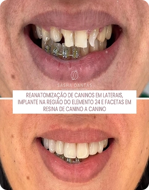 imagem 32