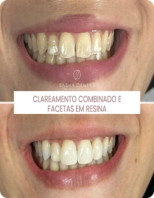 imagem 33