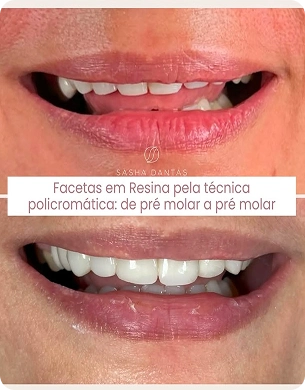 imagem 9